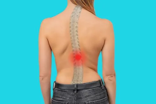 scoliosis-treatment